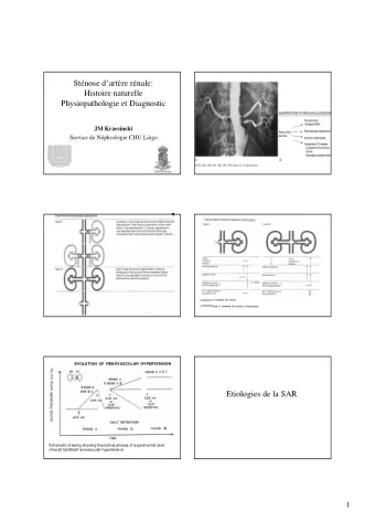 Stnose dartre rnale:  Histoire naturelle  Physiopathologie et Diagnostic  JM Krzesinski