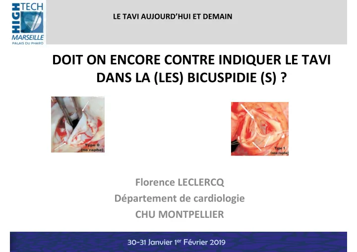 doit on encore contre indiquer le tavi dans la les