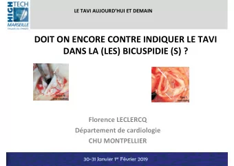 DOIT ON ENCORE CONTRE INDIQUER LE TAVI  DANS LA (LES) BICUSPIDIE (S) ?  Florence LECLERCQ