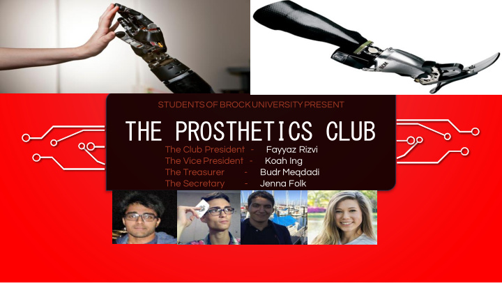 the prosthetics club