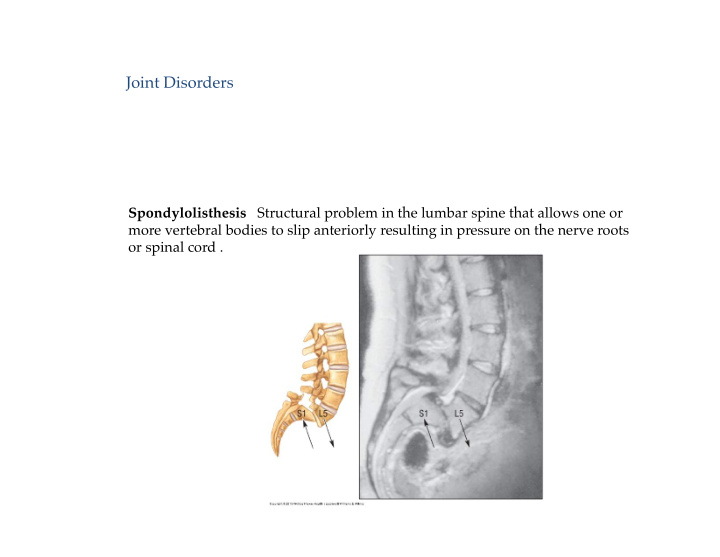 joint disorders