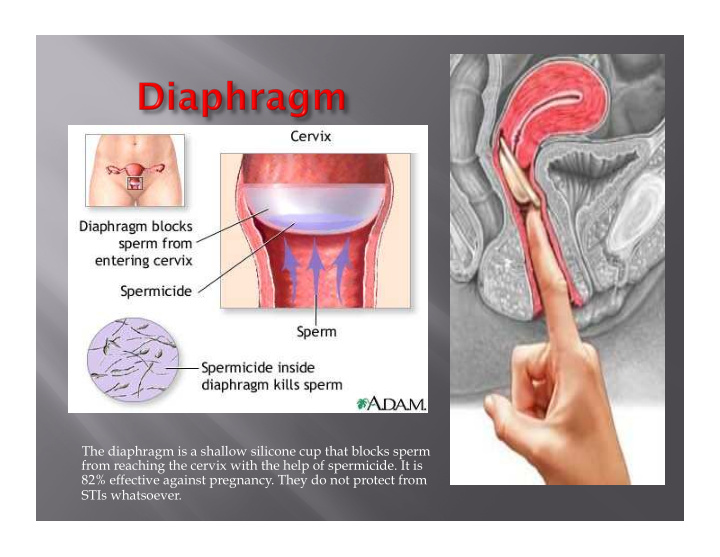 the diaphragm is a shallow silicone cup that blocks sperm