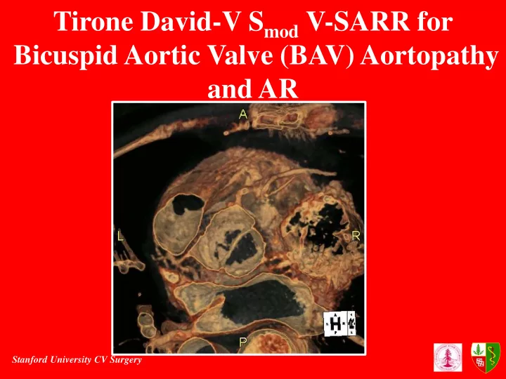 tirone david v s mod v sarr for