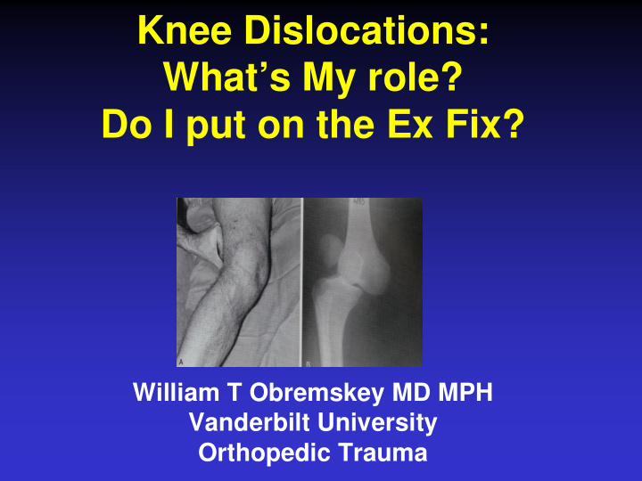 knee dislocations what s my role do i put on the ex fix