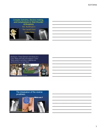 The intoxication of the reverse The intoxication of the reverse  prosthesis  prosthesis  Which one