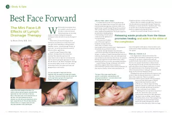 BestFaceForward  More than skin deep  chambers of the eyes, cochlea and dura mater.  Esthetic