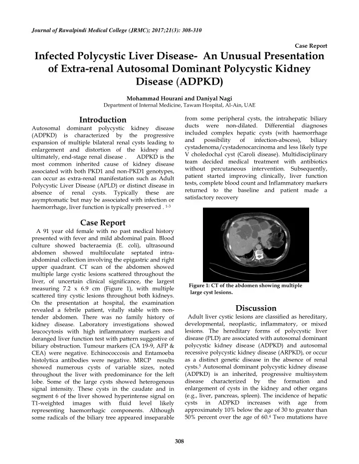infected polycystic liver disease an unusual presentation