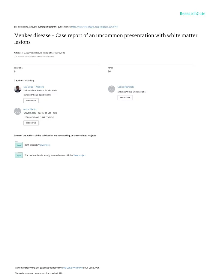 menkes disease case report of an uncommon presentation