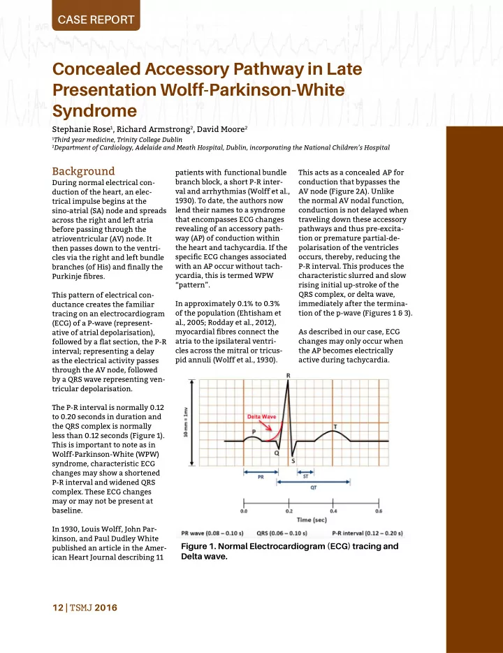 concealed accessory pathway in late presentation wolff
