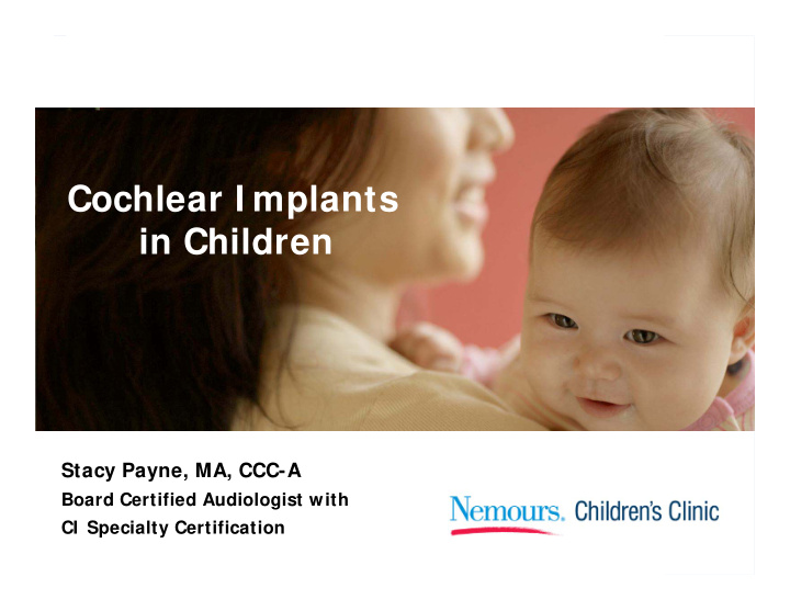 cochlear i mplants in children