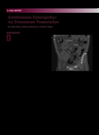 D  complaint, with infection, irritable bowel  syndrome, infmammatory bowel disease  (IBD) and
