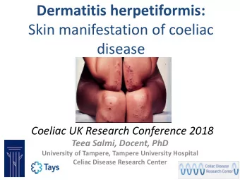 Dermatitis herpetiformis:  Skin manifestation of coeliac  disease  Coeliac UK Research Conference