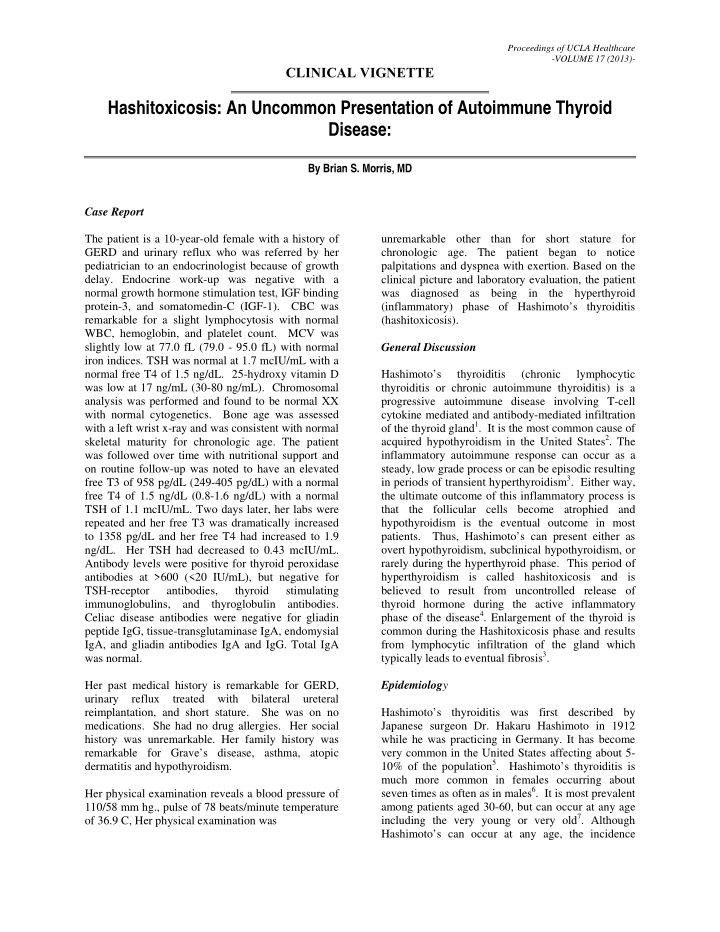 hashitoxicosis an uncommon presentation of autoimmune
