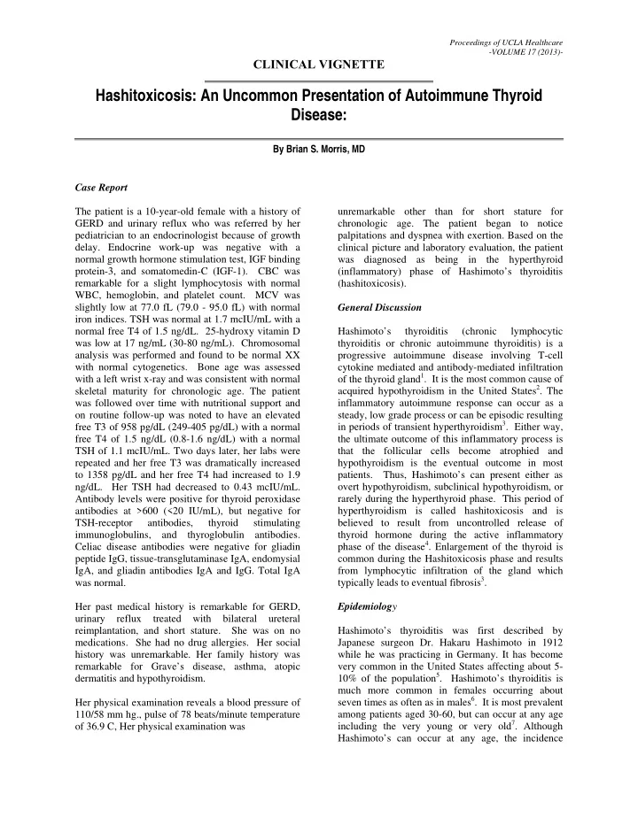 hashitoxicosis an uncommon presentation of autoimmune