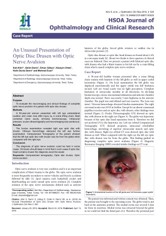 An Unusual Presentation of  luxation of the globe, forced globe rotation or sudden rise in