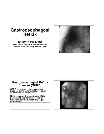 Gastroesophageal  Reflux  Sheryl A Pfeil, MD  Associate Professor of Internal Medicine  The Ohio