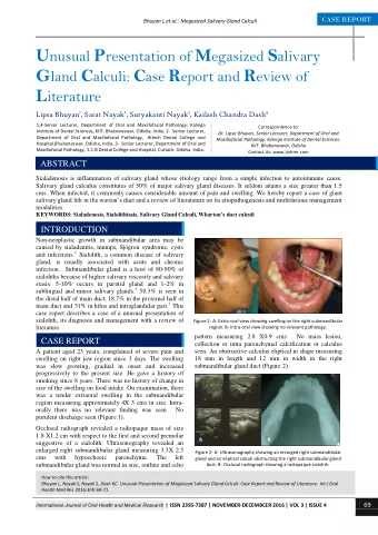 REFERENCES  The patient in this report was only 23 years with a giant  single unilateral calulus