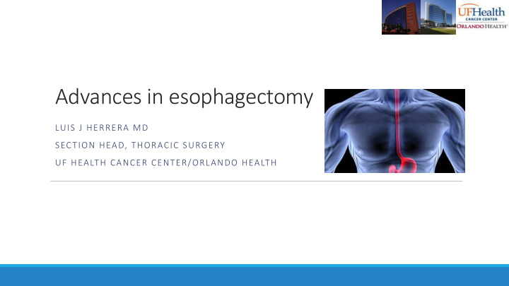 advances in esophagectomy