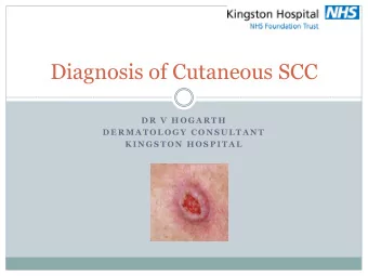 Diagnosis of Cutaneous SCC  D R  V  H O G A R T H  D E R M A T O L O G Y  C O N S U L T A N T  K I