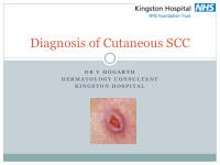diagnosis of cutaneous scc