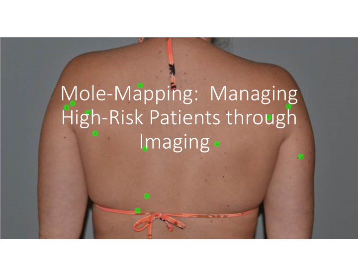 mole mapping managing high risk patients through imaging