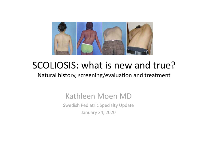 scoliosis what is new and true