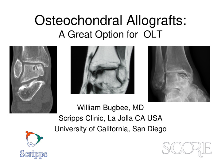 osteochondral allografts