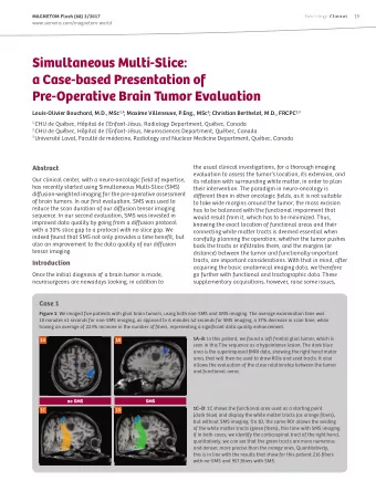 Simultaneous Multi-Slice:  a Case-based Presentation of  Pre-Operative Brain Tumor Evaluation