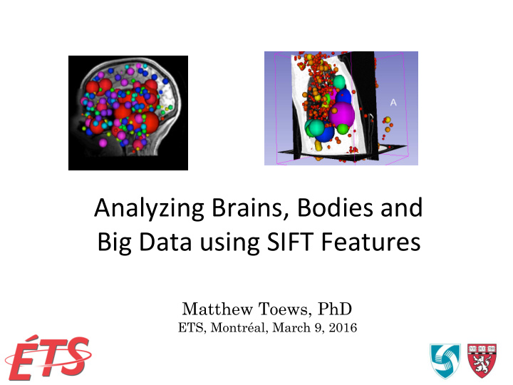 analyzing brains bodies and big data using sift features