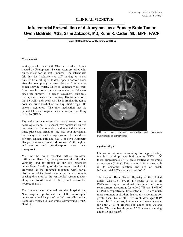 infratentorial presentation of astrocytoma as a primary