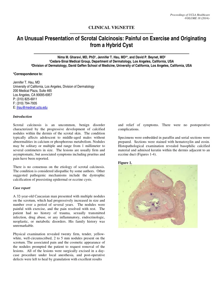 an unusual presentation of scrotal calcinosis painful on