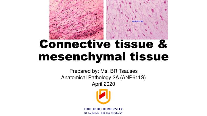 mesenchymal tissue