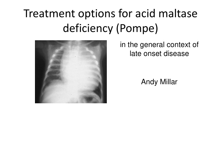 treatment options for acid maltase