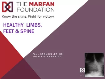 HEALTHY  LIMBS,  FEET &amp; SPINE  P A U L  S P O N S E L L E R  M D  M D  A D A M  B I T T E R M A