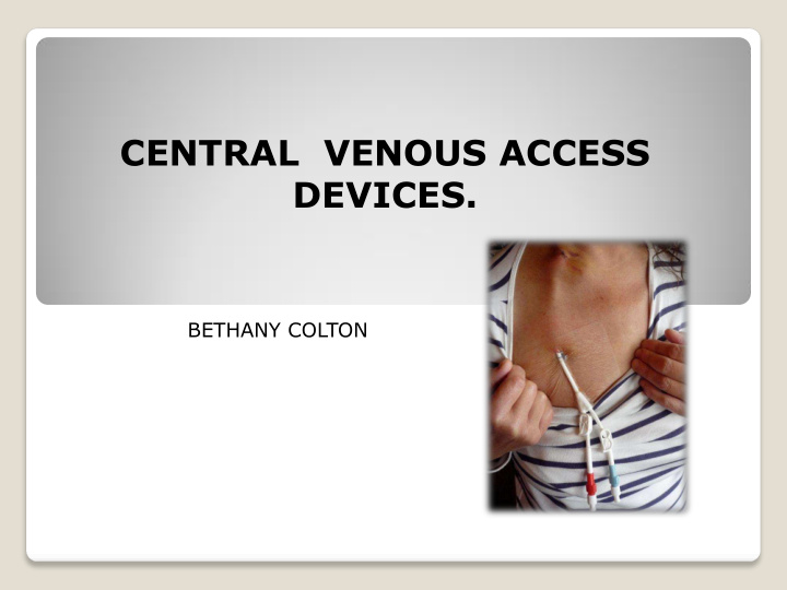 central venous access