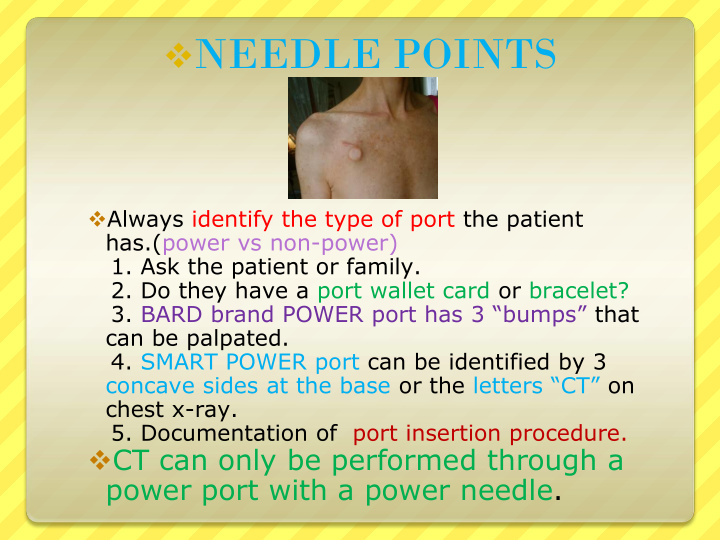 needle points