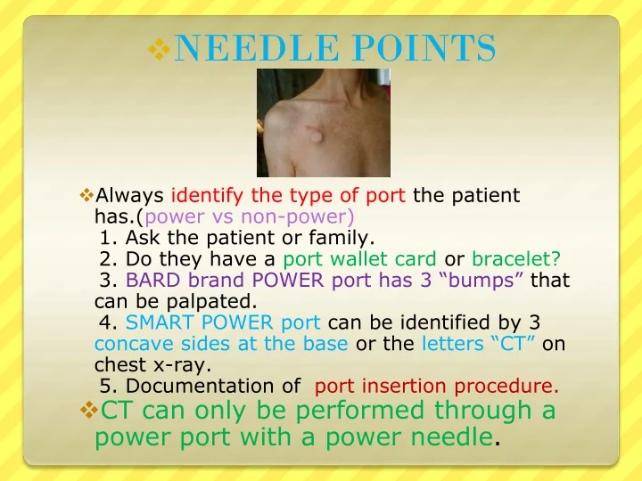 needle points