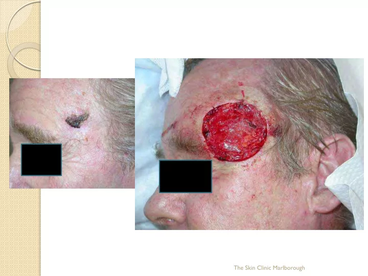 the skin clinic marlborough the skin clinic marlborough