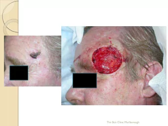 The Skin Clinic Marlborough  The Skin Clinic Marlborough  The Skin Clinic Marlborough  The Skin