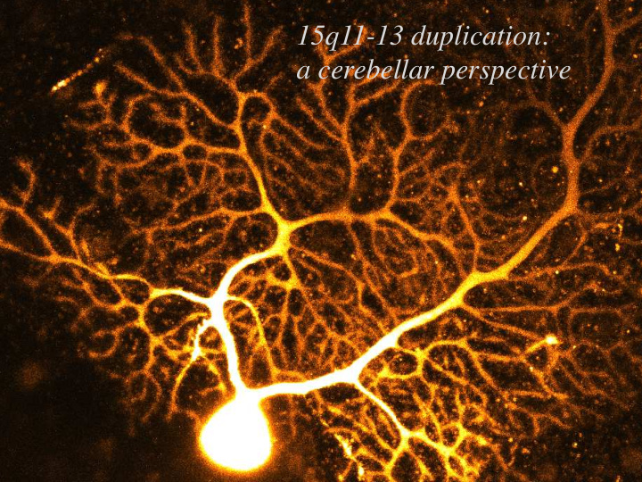 15q11 13 duplication a cerebellar perspective toru takumi