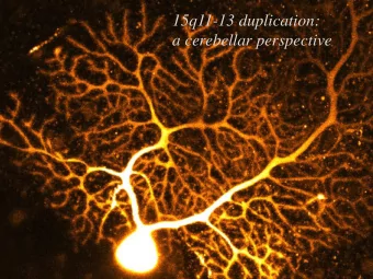 15q11-13 duplication:  a cerebellar perspective  Toru Takumi (RIKEN Brain Science, Japan)  A