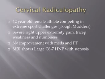 42 year old female athlete competing in  extreme sport challenges (Tough Mudders)  Severe