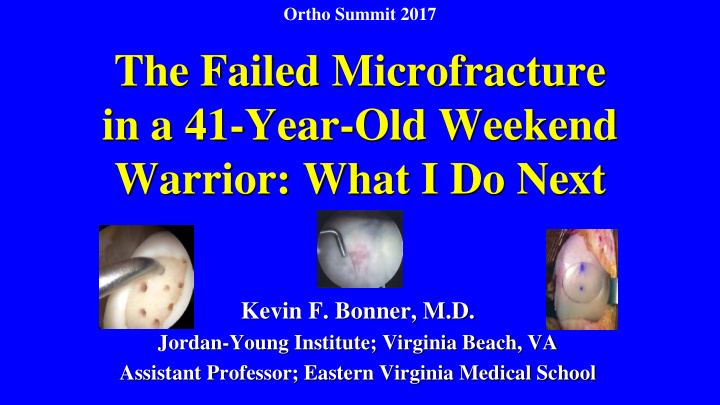 the failed microfracture in a 41 year old weekend warrior