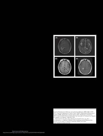 Isolated Choroid Plexus Granulomas: Initial  Presentation of Neurosarcoidosis?  Michael E. Kallen,