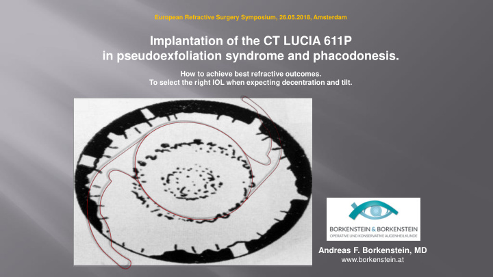 implantation of the ct lucia 611p