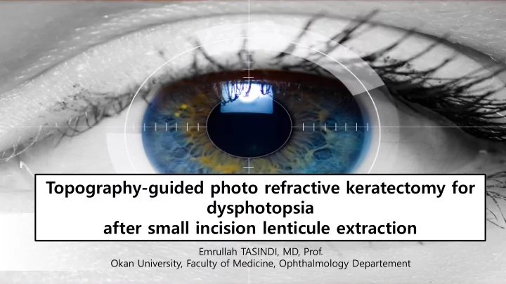topography guided photo refractive keratectomy for