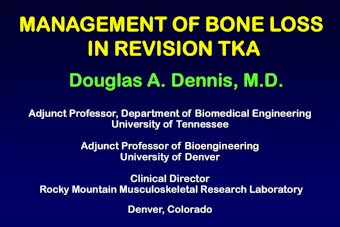 MANAGEMENT  MAN  NT O  OF BO  F BONE L  LOSS  IN RE  IN  REVI  VISION TKA  N TKA  Douglas  Doug