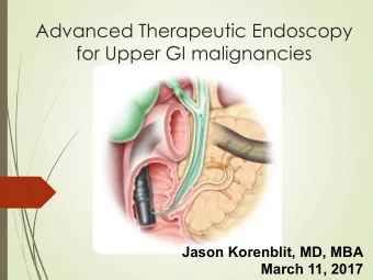 Advanced Therapeutic Endoscopy  for Upper GI malignancies  Jason Korenblit, MD, MBA  March 11, 2017