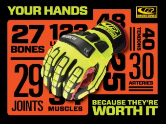 70%  COST OF AVERAGE SEVERED TENDON  $70 K  OF HAND INJURIES RESULT  FROM NOT WEARING ANY  TYPE OF