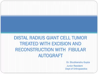 REC  ECONS  ONSTR  TRUCTION  UCTION WI  WITH FI  FIBULAR  BULAR  AUTOGRAFT  OGRAFT  Dr. Shubhan